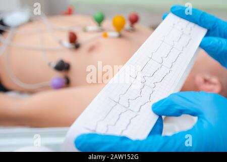 Heart cardiogram in the hands of a doctor close-up. Cardiologist is studying the testimony of an electrocardiograph. Stock Photo