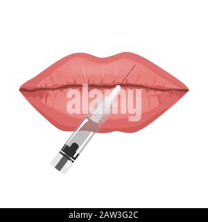 Lips filler injections concept, vector illustration. Lip augmentation. Hyaluronic Acid injections Stock Vector