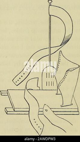 On the cure of club-foot without cutting tendons : and on certain new methods of treating other deformities . division of the tendons, the foot, ac-cording to the orthopaedic fashion, is fastenedinto a metal clog provided with screws, and aspring intended to press the limb into shape.At the present day these instruments are allfounded on the same principle, taken fromScarpas plan, although almost every ortho-paedist has a shoe of his own, in which hesees certain excellences, absent in his neigh-bours. Before Stromeyer ultimately esta-blished the immediate safety of subcutaneoustenotomy, shoes Stock Photo