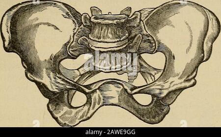 ObstetricsA manual for students and practitioners . Rachitic Pelvis ...