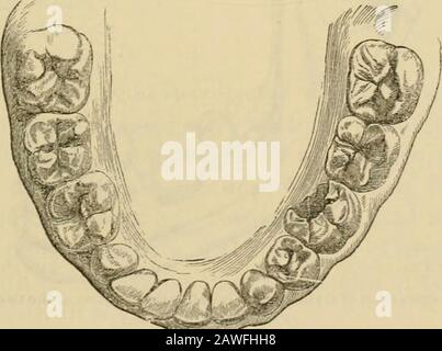 Manual of dental surgery and pathology . Upper jaw. Impression cup
