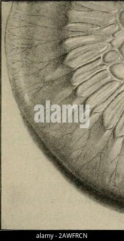 Operative surgery, for students and practitioners . Fig. 188.—Section of Intestine and its Mesentery to show Separation of itsLayers and the Dead Space.. j^im Stock Photo