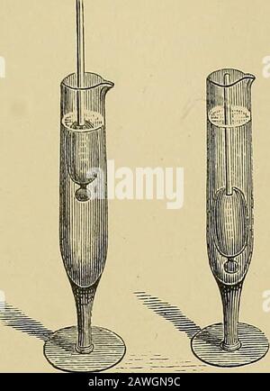 Kidney diseases, urinary deposits, and calculous disorders : their ...
