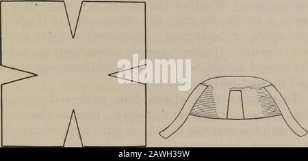 Practical nursing : a text-book for nurses . adhesive plaster put on asshown in Fig. 28; leave three of these strips about twoinches longer than the paper—these attach the cap tothe body; one side is not so attached, and this can beslightly raised to look under, to see if the blister isformed. Tape can be used instead of adhesive plaster;it will, of course, have to be sewn on. If tape is used,only two pieces need be left longer than the cap andthese can be tied around the part on which the plasteris applied. Cut as much of the corners off the cap as 1 Never fasten a plaster on with adhesive pl Stock Photo