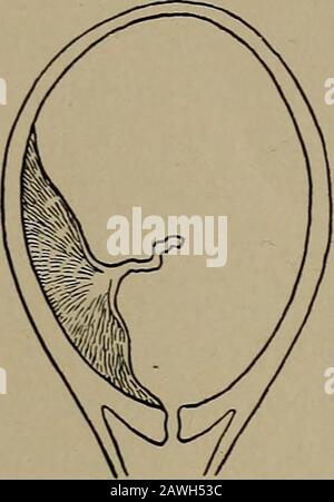 A handbook of obstetrical nursing for nurses, students, and mothers . llen,  immediately afternursing.* For any nipple shield to work perfectly it  mustQual£iesoffit tightly, hence an entire rubber shield is not  soshield-good