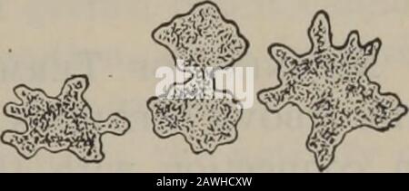 Practical nursing : a text-book for nurses . and favus. There is also a disease of themucous membrane of the mouth, known as thrush,which is due to a microorganism, known as the 1 Latin alga—seaweed (plural algae). Bacteriology 37 oidium albicans, that resembles both yeasts andmolds. Conditions which Favor the Development ofMolds.—The conditions that favor the developmentof the molds are the same as those which favor that ofbacteria. The more important of these, as previously-stated, are (i) the presence of material upon whichthey can feed, (2) moisture, (3) warmth, (4) anabsence of sunlight. Stock Photo