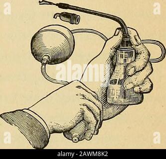 Diptheria, its nature and treatment . CAVIDSON RUBBER CO. DAVIDSON RUBBER CO. Fig. 11.—Davidson Anatomizer, No. 59. Fig. 12.—Davidson Anatomizer, No. 6. stance, solutions of permanganate of potassium (3 to 5 grainsto the ounce), peroxide of hydrogen (one in four of water),bichloride of mercury (one in 4000 to 10,000), borax or boracicacid (one to three per cent, solution), salicylic acid (one in 500to 2000), etc. The special utilities and drawbacks of these andother valuable substances, and also the manner in which theymay be employed, have already been stated. When the solvent ferments are ap Stock Photo