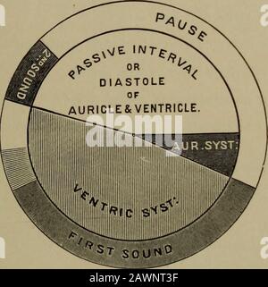 . Physical diagnosis . he aortic second sound or produce characteristic ...