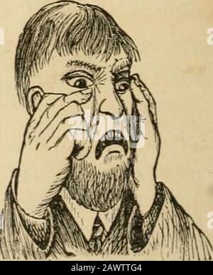 'Quad's odds'; . ashioned out-door oven, simply becausethey had the toothache. Watkins is one ofthose sort of men. He just gets comfort-ably around the stove, with a paper in one hand and a panof apples in the other, when whoop ! she goes! It seemsas if some one had fired a bullet into his jaw, and he leapsup and down and kicks out behind and grabs at his face.ISTow,Watkins, do be patient! says his wife, as sheruns after cotton and camphor. He holds his mouth open and she puts the cotton in,having soaked it with camphor. He gets a swallow of theliquid, which goes down the wrong pipe, and he gi Stock Photo