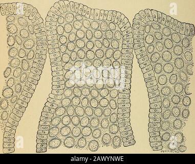 Treatise on gynæcology : medical and surgical . y preserve their normal volume anddiffer in that respect, and in the small amount of their protoplasm,from the cells of the placenta. In other words, we have to do (Fig.96) with an acute interstitial inflammation.10 Chronic Metritis.—The parenchymatous lesions of chronic metri-tis are particularly characterized by a hypertrophy of the connective 138 CLINICAL AND OPERATIVE GYNECOLOGY. tissue, causing a general enlargement of the organ, which, however,does not exceed the size of a fist. This increase in volume may beabsent altogether, and then we h Stock Photo