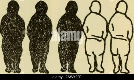 Our boys : a study of the 245,000 sixteen, seventeen and eighteen year old employed boys of the state of New York . DIAGRAM FIn Greater New York one boy out of five is foreign born. DIAGRAM GIn Greater New York three boys ox;t of five have both parents foreign born Stock Photo