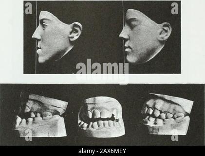 The Annals and magazine of natural history; zoology, botany, and geology.  Natural history; Zoology; Botany; Geology. Dr. A. Giiiither on the British  Species of Mugil. 347. extremity of the maxillary bone