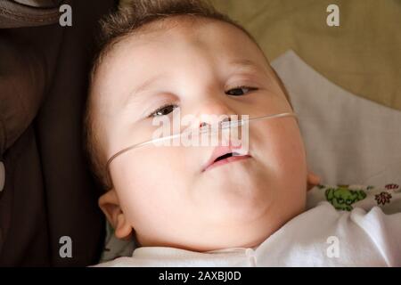 Baby boy with cerebral palsy is getting oxygen via nasal prongs to assure oxygen saturation. Nasal catheter in a child patient in hospital. Respirator Stock Photo