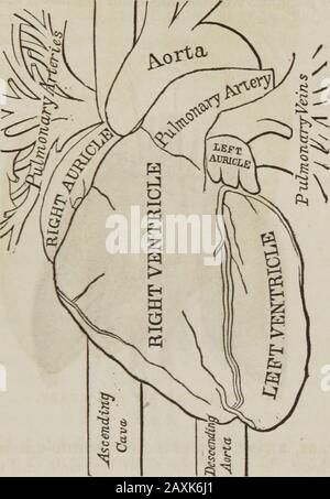 Heart, Arch Of The Aorta And Coronary Arteries, Cat (computerized Axial 