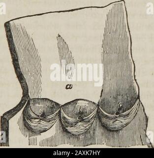 Human physiology : designed for colleges and the higher classes in schools and for general reading . VALVES OF THE AORTA. with blood for their growth and repair, for the heart is con-structed and repaired from its own blood. The valves at theorifice of the pulmonary artery are arranged in the same man-ner as those which are at the orifice of the aorta. 121. The valves which are between the auricles and the7* 78 HUMAN PHYSIOLOGY. Arrangement of the valves between the auricles and ventricles. ventricles I have already partially described. They are foldsof strong white membrane, their edges being Stock Photo