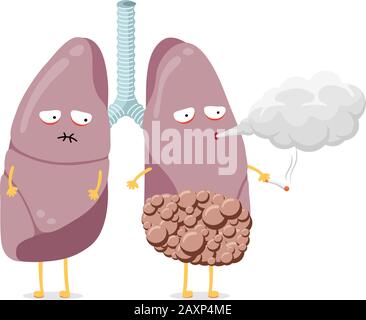 Smoker lungs. Smoke human damage lung cancer vector medical infographic ...