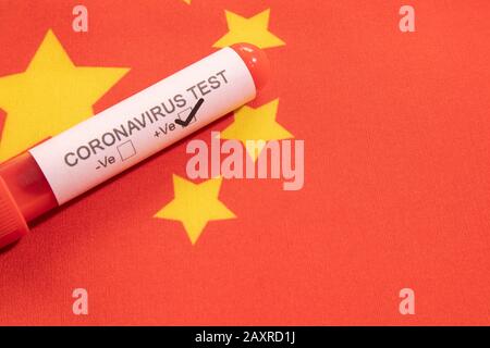 Coronavirus positive test on blood collection tubes on Chinese flag - concept of virus found in China. Stock Photo