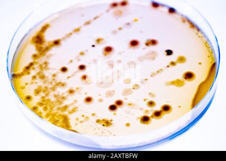 Mixed of bacteria colonies and fungus in various petri dish Stock Photo