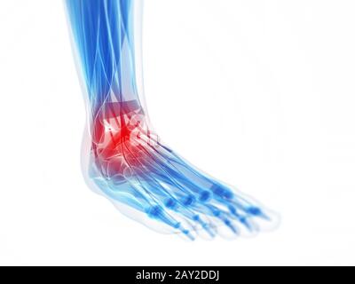 3d rendered illustration of a painful foot Stock Photo