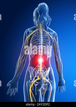 3d rendered medical illustration - painful nerves Stock Photo