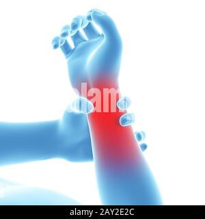 3d rendered illustration of a man having pain in the arm Stock Photo