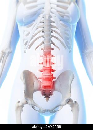 3d rendered illustration of a painful lower spine Stock Photo