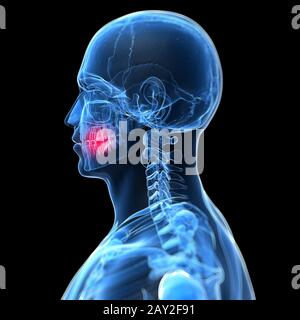 3d rendered illustration of painful teeth Stock Photo