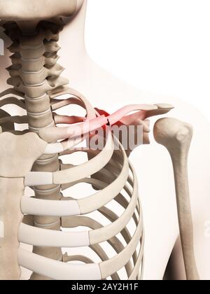 medical illustration of a broken clavicle Stock Photo