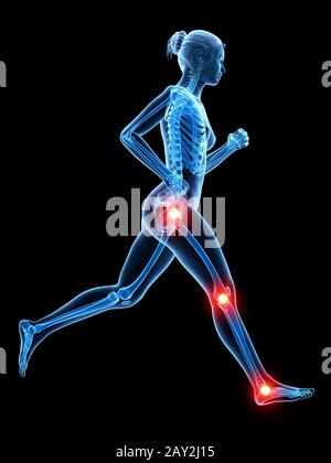 3d rendered illustration - painful joggers joints Stock Photo