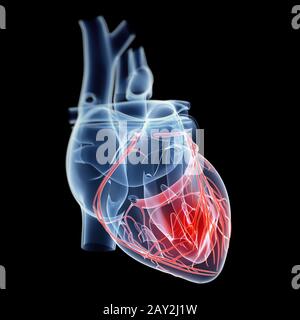 illustration showing pain in the heart Stock Photo