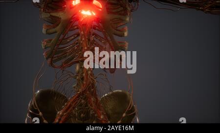 CG Animation Of A Sick Human Heart Stock Photo