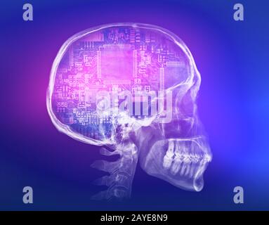 Human skull X-ray image. Artificial intelligence concept Stock Photo