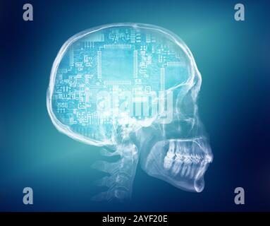 Human skull X-ray image. Artificial intelligence concept Stock Photo