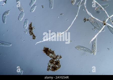 Plankton with microscopic ciliates Stock Photo