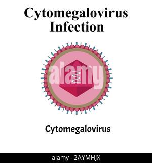Cytamegalovirus structure. Viral infection cytomegalovirus. Sexually transmitted diseases. Infographics. Vector illustration on isolated background. Stock Vector
