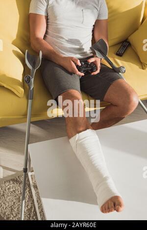 KYIV, UKRAINE - JANUARY 21, 2020: Cropped view of man with broken leg playing video game near crutches and remote controller on couch Stock Photo