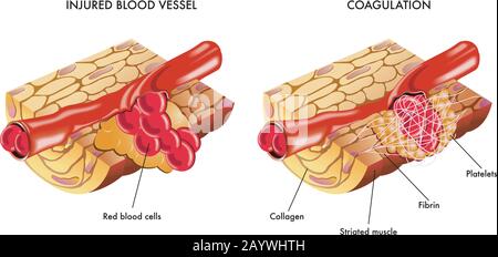 Medical illustration of the process of blood coagulation. Stock Vector