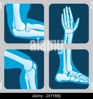 Human joints, knee joint, elbow joint, ankle joint, wrist. Medical orthopedic vector of set. Anatomy orthopedic human joint and illustration icon leg and hand joint Stock Vector