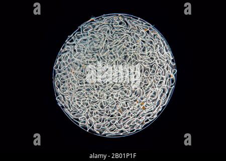 Fallen Star, star jelly, witch's butter, mare's eggs (Nostoc spec.), mass of Nostoc in darkfield, Germany Stock Photo