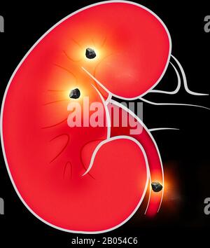 Human body view of kidneys. The kidneys are two bean-shaped organs found in vertebrates. Kidney stones Stock Photo