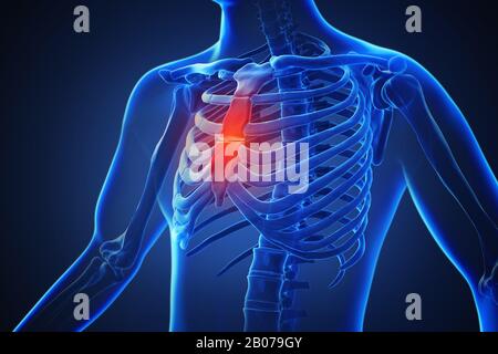 3d rendering of a human body with highlighted in pain 019 Stock Photo ...