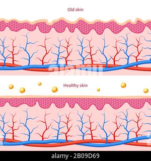 Collagen human skin effect. Close up damaged old and healthy vector medical skin care cosmetic diagrams. Layer of himan skin illustration Stock Vector