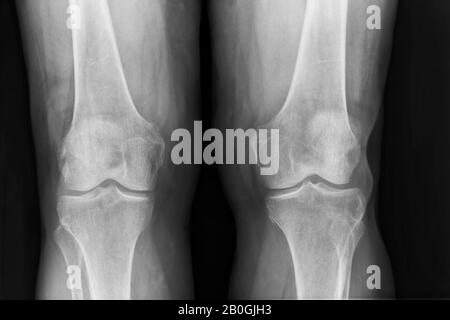 Standing skeleton, frontal view Stock Photo - Alamy