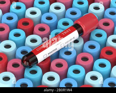 3d render of coronavirus 2019-nCoV blood samples in row Stock Photo