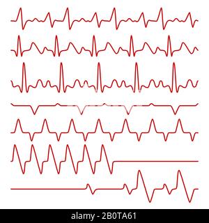 Line vector cardiograms or electrocardiogram on monitor, heartbeat medical symbols. Cardiogram pulse heart, illustration of chart pulse heartbeat Stock Vector