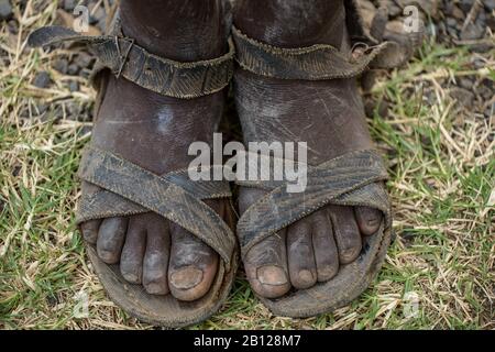 Dirty feet of an Ethiopian teenager, Ethiopia Stock Photo