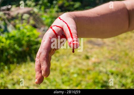 Hand in the blood. Close-up on the background of greenery. From the wound on the finger bleeds. A typical injury with a knife, glass, sharp objects. Stock Photo