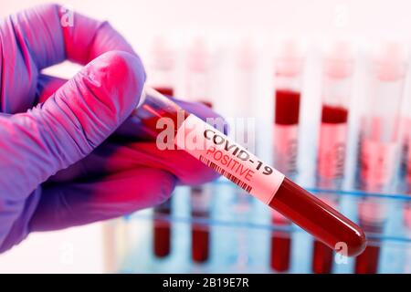 Close up of microbiologist hand with surgical gloves holding a positive blood test result for coronavirus. Test tubes rack with blood sample for covid Stock Photo