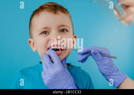 Small patient does not want to open the dentist's mouth on blue background. Dantist treats teeth. close up view of dentist treating teeth of little Stock Photo