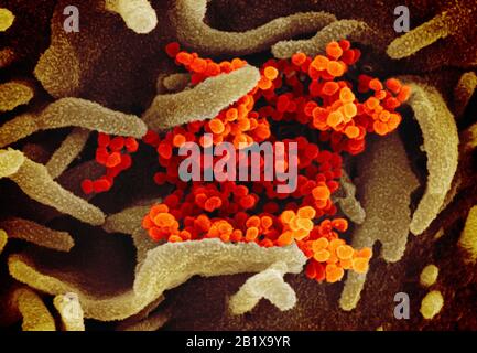 COVID-19. Novel Coronavirus SARS-CoV-2  This scanning electron microscope image shows SARS-CoV-2 (orange)—also known as 2019-nCoV, the virus that causes COVID-19—isolated from a patient in the U.S., emerging from the surface of cells (green) cultured in the lab. Credit: NIAID-RML Stock Photo